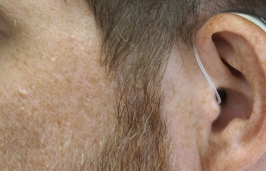 aparate auditive bune