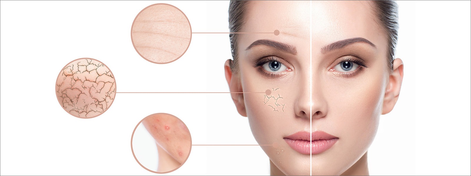 Cea mai buna crema acnee